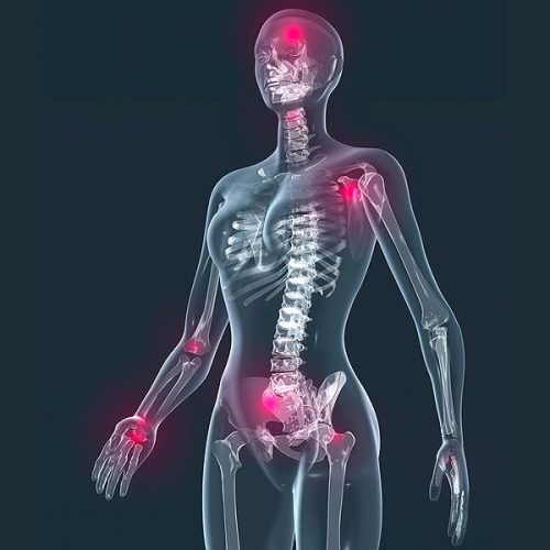 dt_150211_fibromyalgia_800x600 dt_150211_fibromyalgia_800x600